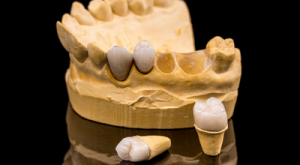 Tipos de próteses dentárias